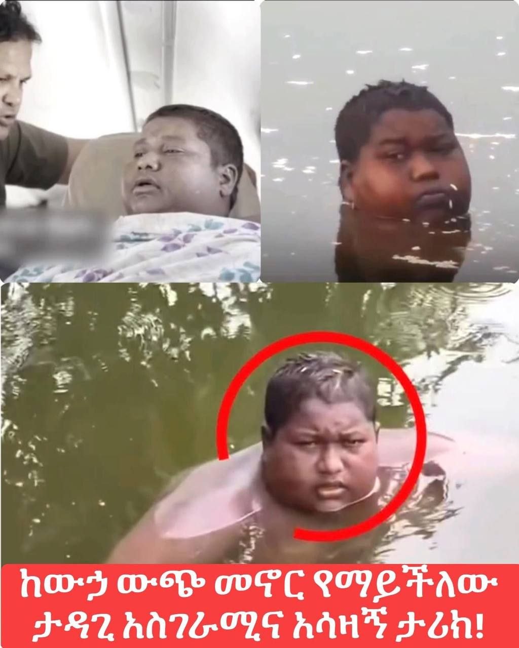 ከውኃ ውጭ መኖር የማይችለው ታዳጊ አስገራሚና አሳዛኝ ታሪክ!